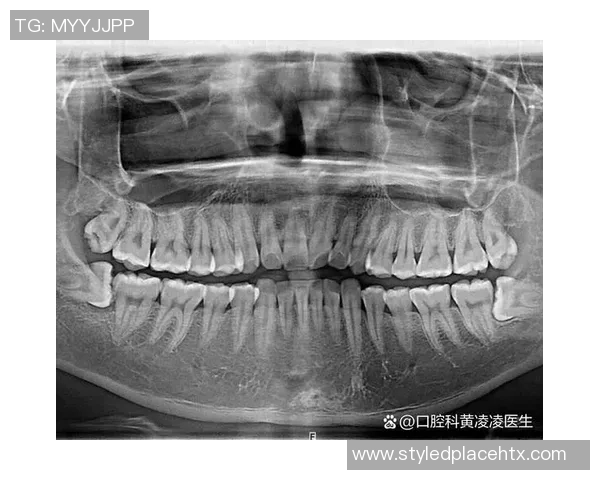 奇克遭遇牙槽骨骨折多颗牙齿脱落或将影响近期进食与讲话能力 奇克遭遇牙槽骨骨折多颗牙齿脱落或将影响近期进食与讲话能力